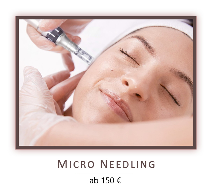 microneedling